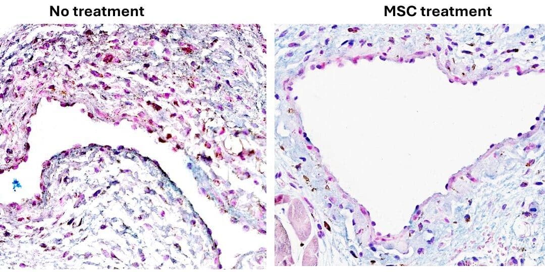 Stem Cells May Transform Kidney Disease Treatment | The Stem Cell Club